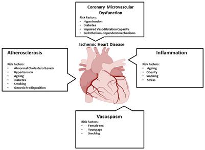 Regenerative Medicine for the Treatment of Ischemic Heart Disease; Status and Future Perspectives